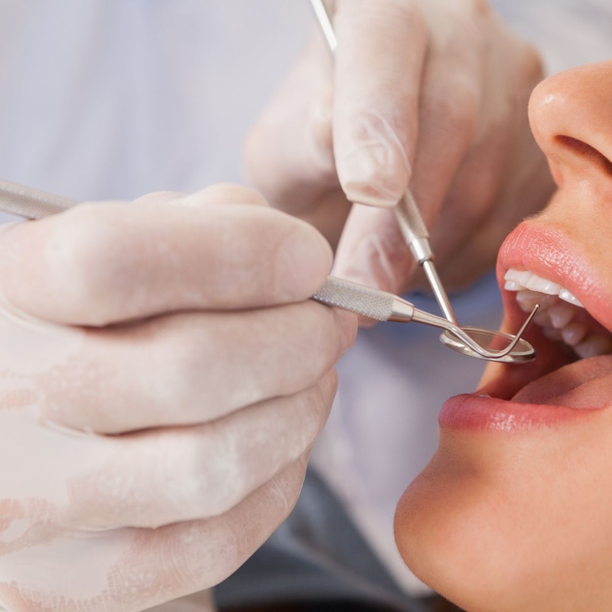 Best Daily Habits to Prevent Gum Disease