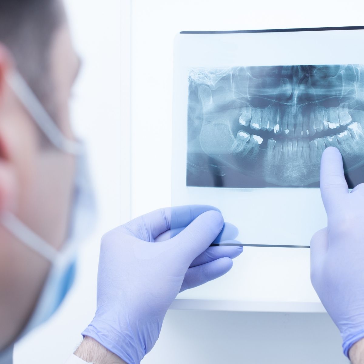 How Digital X-Rays Improve Dental Diagnosis and Patient Safety