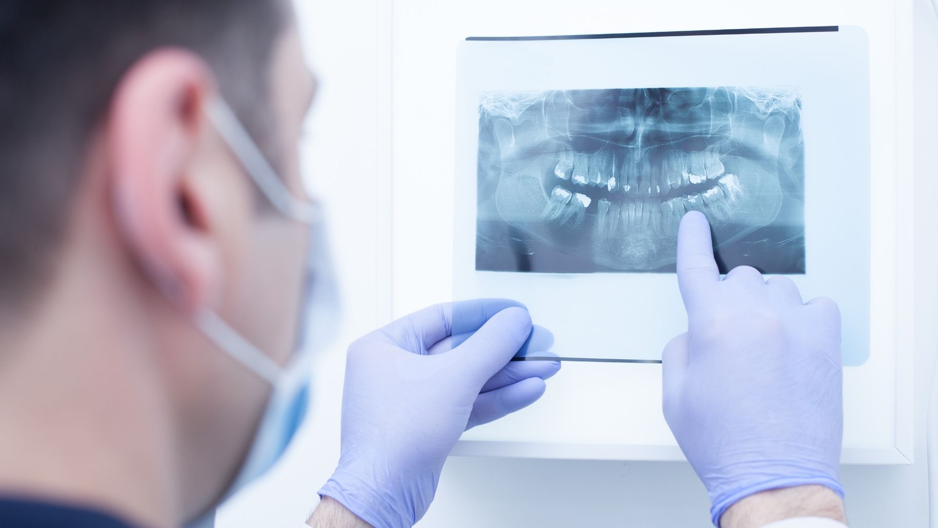 Tips for Helping Kids Overcome Dental Anxiety