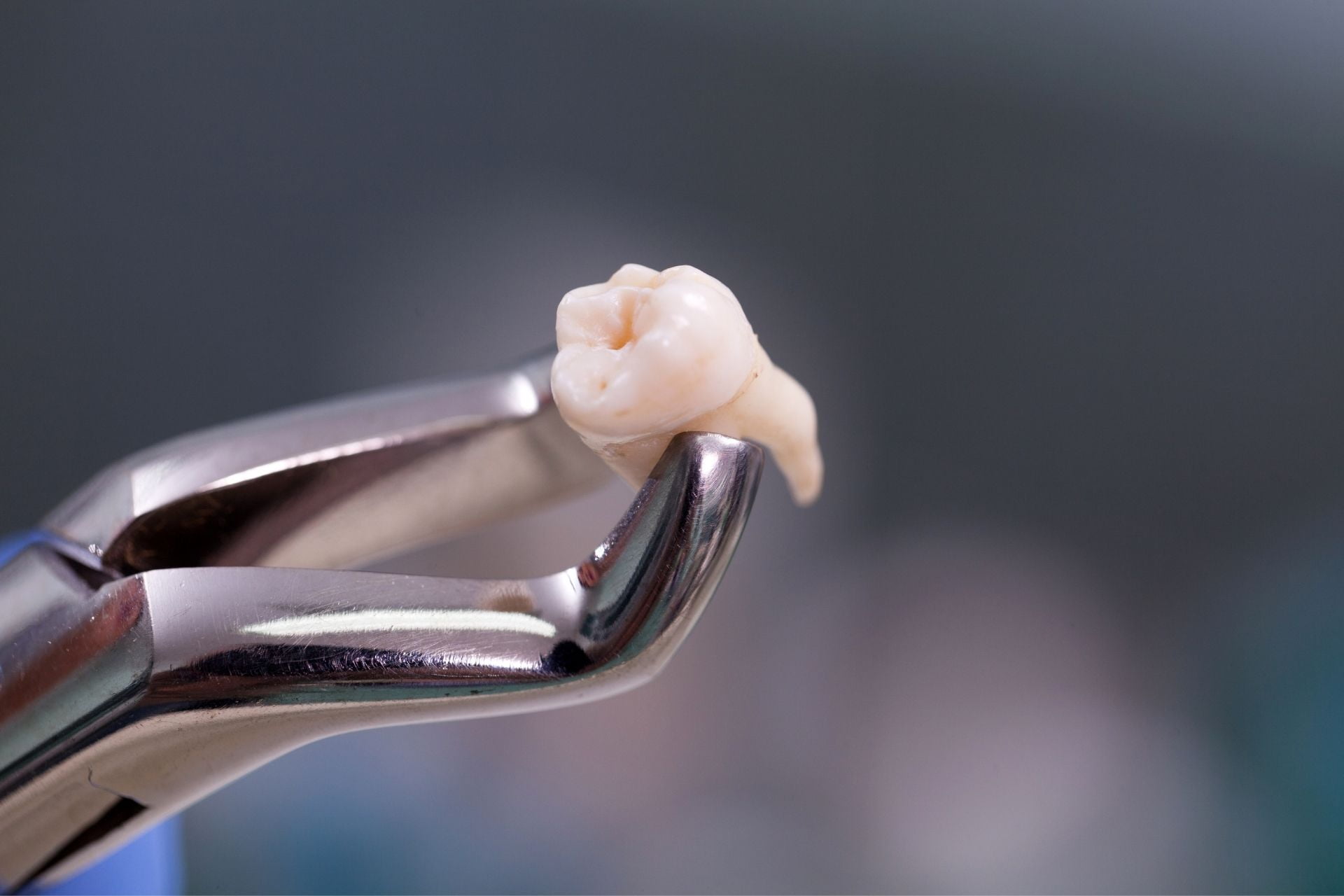 How to Tell If a Dental Abscess Is Life-Threatening