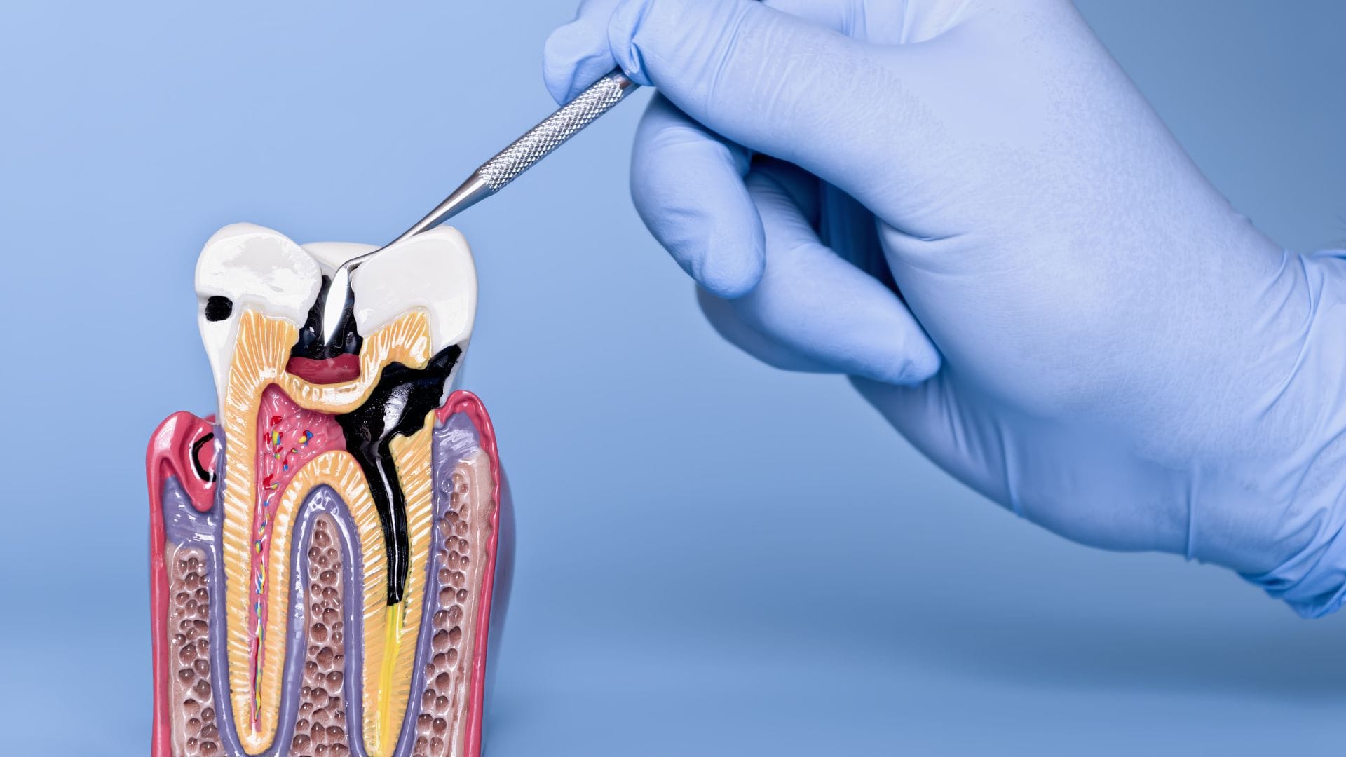 How Smoking Affects Your Oral Health